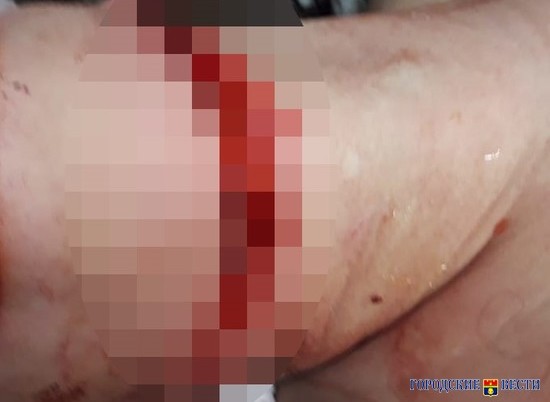 Насильник перерезал горло 26-летней жертве в Калаче-на-Дону