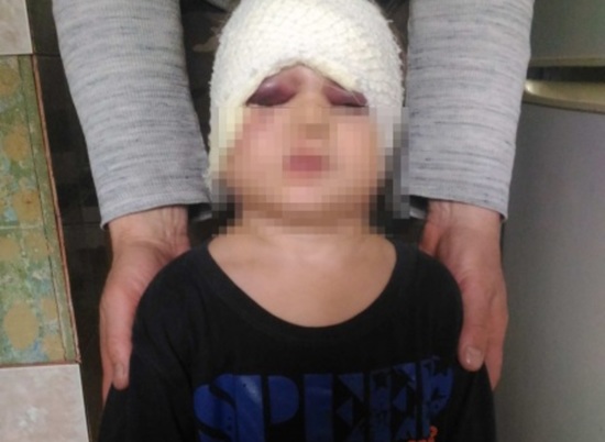 Прокуратура вмешалась в ситуацию с избитым 3-летнем ребенком под Волгоградом