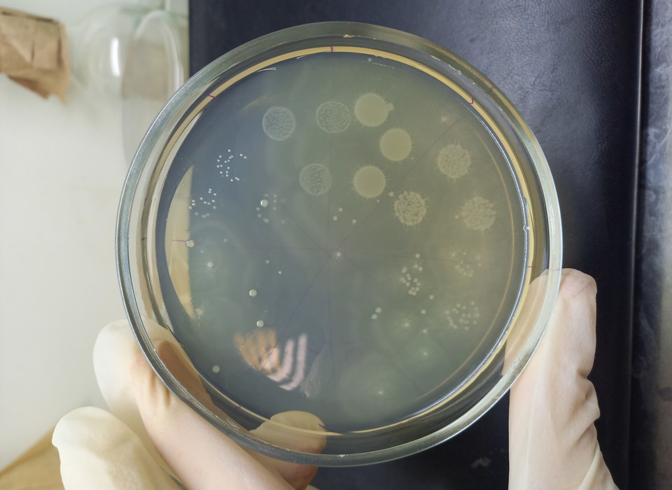Волгоградцам рассказали 8 интересных фактов о микробах