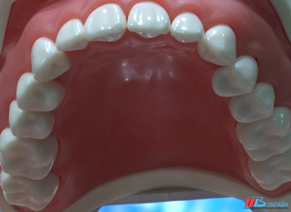 Стоматолог из Волгограда объяснил, как сладкая газировка и ириски портят зубы